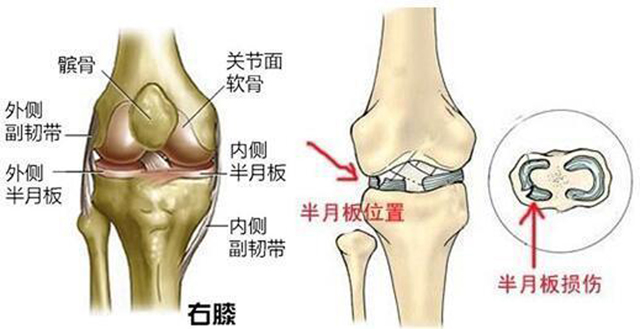 关节软骨的位置图片