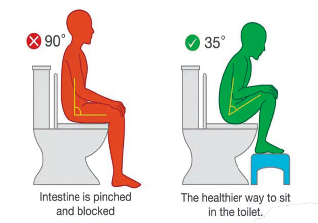肠子被捏堵，建议坐马桶时脚踩小板凳提高膝盖高度，保持一定的双腿开合度，让肠道蠕动更顺畅。