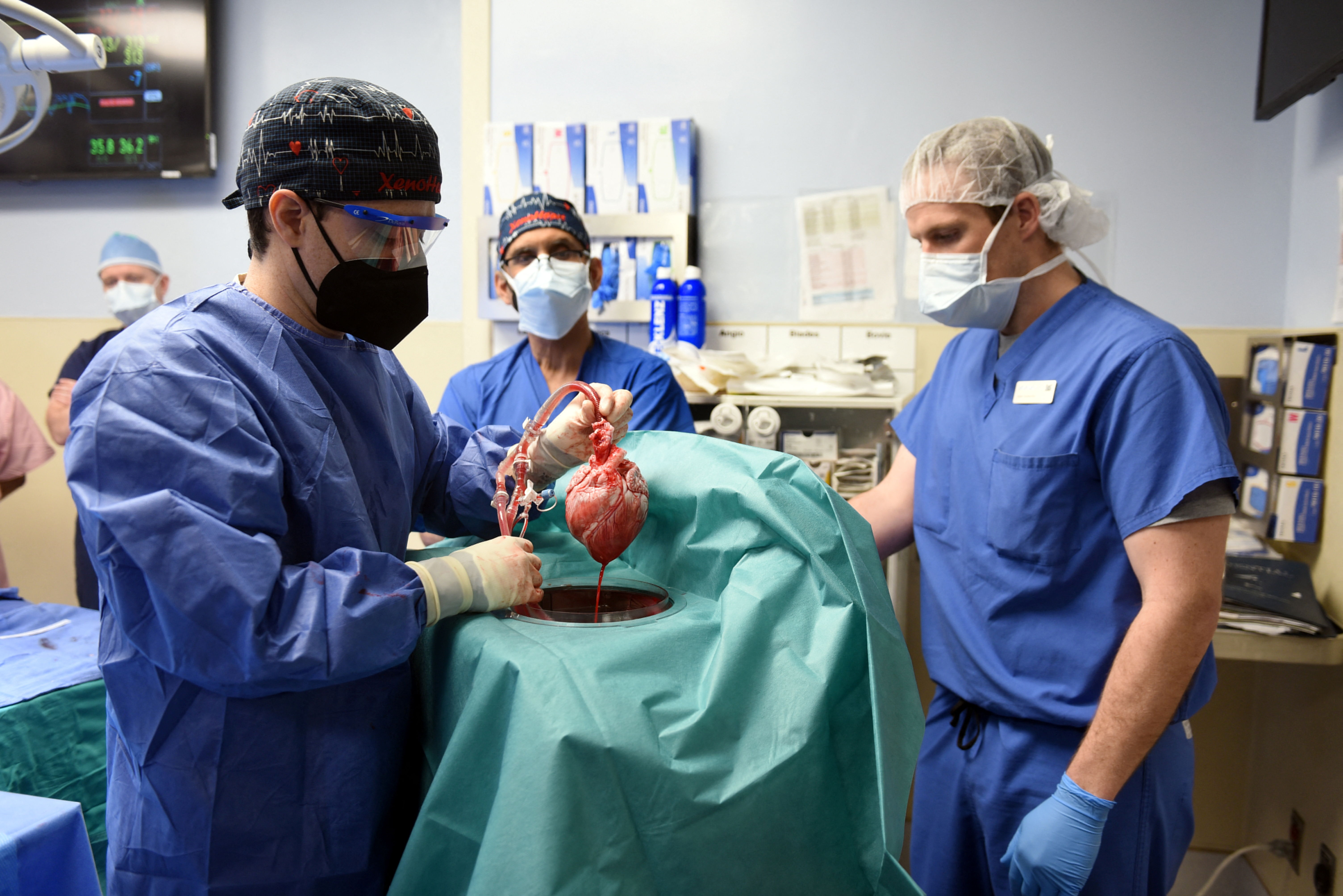 Surgeon Muhammad M. Mohiuddin, MD leads a team placing a genetically-modified pig heart into a storage device at the Xenotransplant lab before its transplant on David Bennett, a 57-year-old patient with terminal heart disease, at University of Maryland Medical Center in Baltimore, Maryland, U.S. January 7, 2022. Picture taken January 7, 2022.  University of Maryland School of Medicine (UMSOM)/Handout via REUTERS.  NO RESALES. NO ARCHIVES. THIS IMAGE HAS BEEN SUPPLIED BY A THIRD PARTY. MANDATORY CREDIT