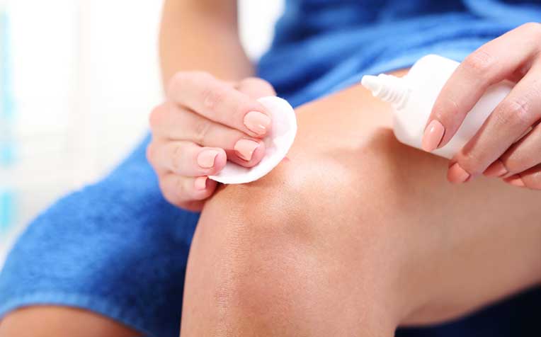 How to Clean and Treat a Skin Wound