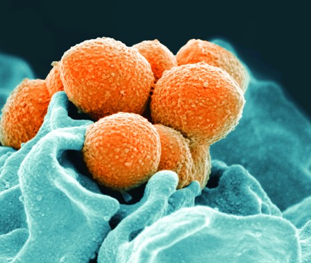 An infectious diseases expert says lower-than-usual uptake of the flu vaccine in much of Canada may be partly responsible for high numbers of a bacterial infection that has been deadly in rare cases, especially among children. An electron microscope image shows Group A Streptococcus in orange. THE CANADIAN PRESS/AP-NIAID via AP