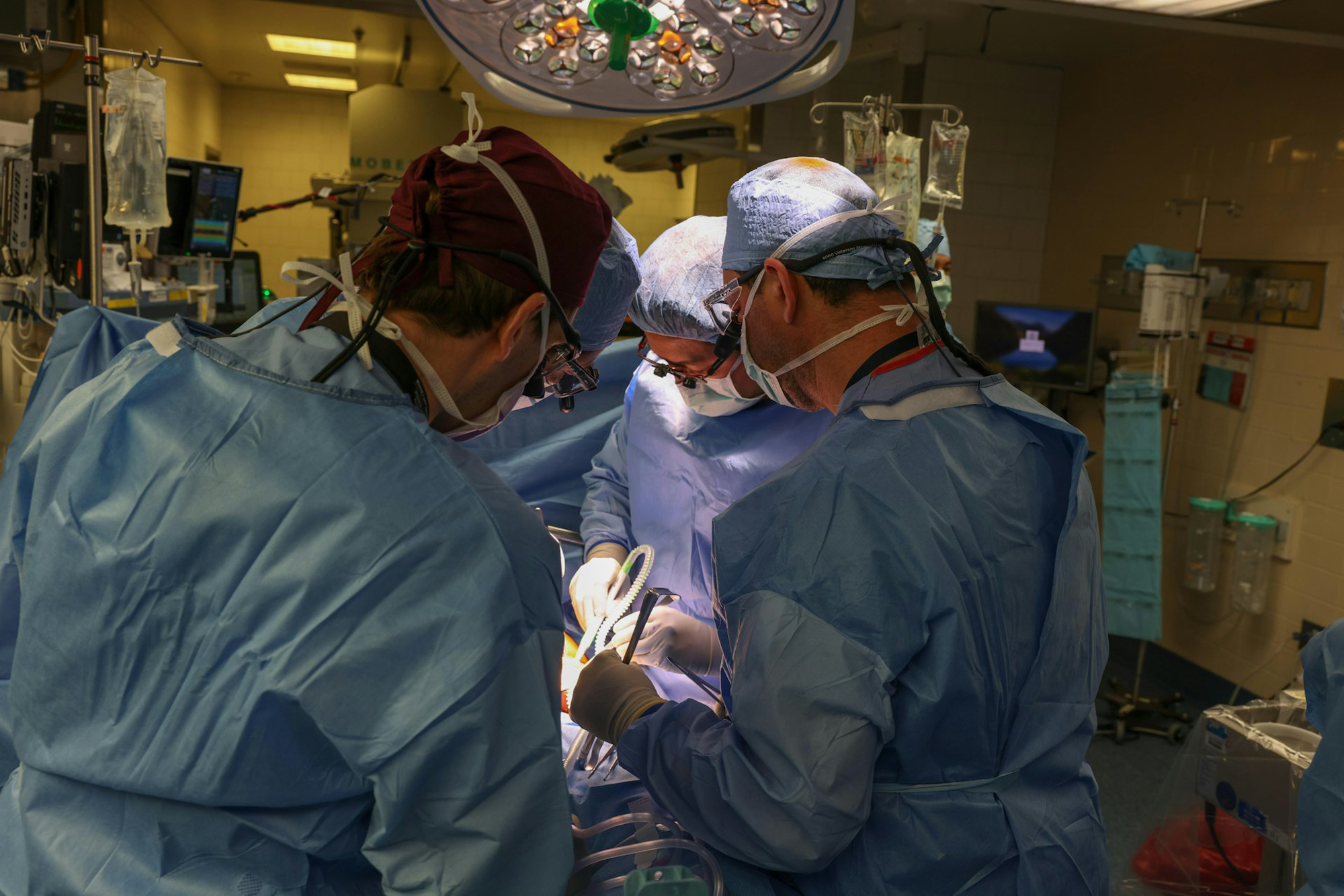 美国波士顿的马萨诸塞州总医院宣布，成功为一名患有末期肾病的62岁男子，移植经过基因编辑的猪肾，为全球首例。
