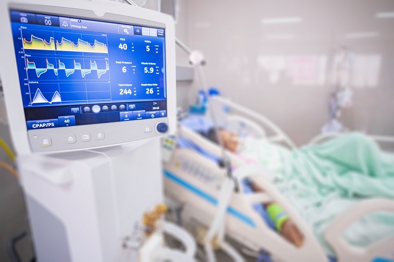 Ventilator monitor ,given oxygen by intubation tube to patient, setting in ICU/Emergency room